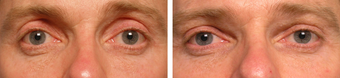 Injectable Treatments before 1200512