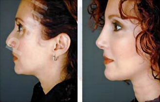Complete Facial Rejuvenation 138188