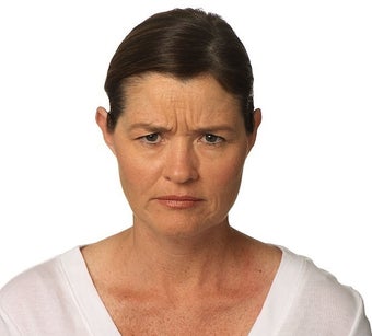 Woman treated with Botox for frown lines before 1328545