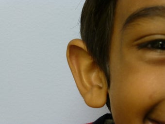 Childs otoplasty 877671