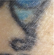 One Spot Disappears after 1032318