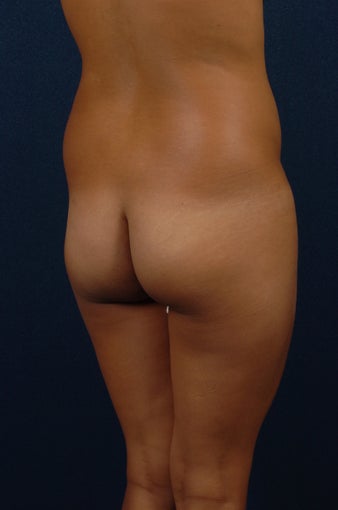 25 Year Old Female - before 269891