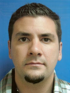 Otoplasty Ear Surgery - Male after 818058