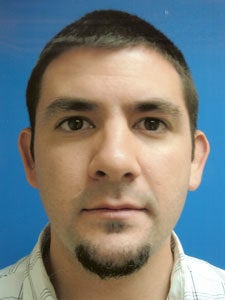 Otoplasty Ear Surgery - Male before 818058