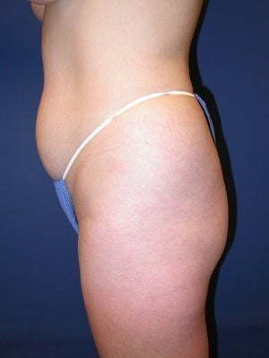 40 year old female, 5'4" 137 lbs. before 856552