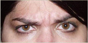 Botox before 748934