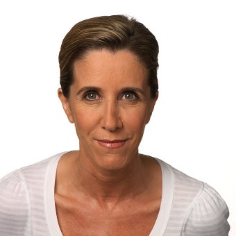 Frown lines relaxed with Botox after 1328546
