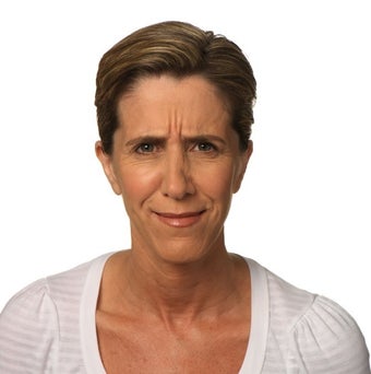 Frown lines relaxed with Botox before 1328546