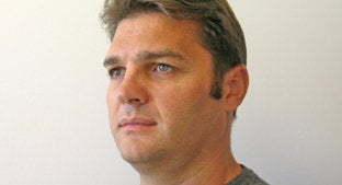 Facial Implant before 494443