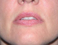 Injectables before 112082
