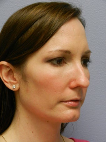 Before and After Skin Care 635902