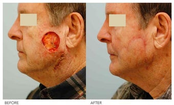 Facial Reconstruction before 136844