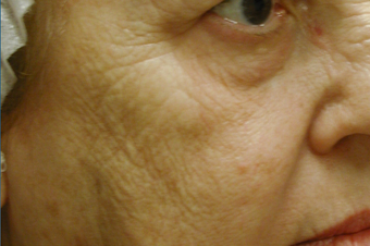 Affirm CO2 before 200601