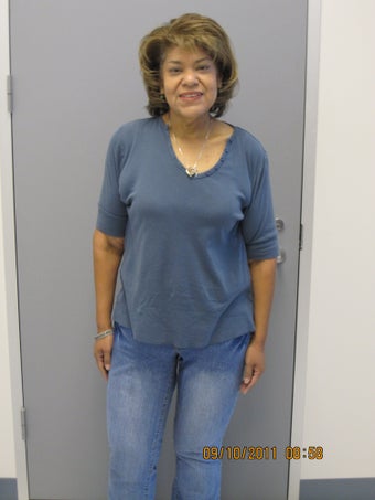 Gastric Bypass after 381950
