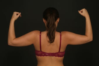 Arm Lift after 289477