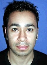 Ear Surgery (Otoplasty) after 357650