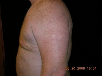 Cool Lipo 245621