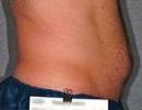 Liposonix 582729