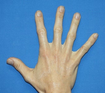Filler in Hands after 385694