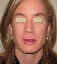Skincare after 112110