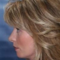 Revision Rhinoplasty 442999