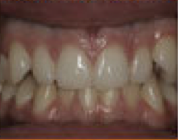 Damon System Braces 477296
