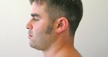 Chin Liposuction 490757