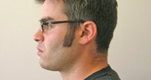 Chin Liposuction 490757