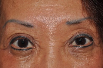 Permanent Eyeliner after 493461