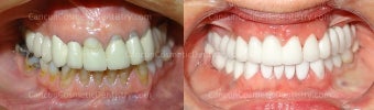 Extreme Dental Makeover before 534284