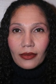 African American Rhinoplasty after 448670