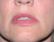 Injectables after 112082