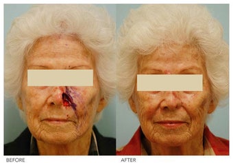 Facial Reconstruction before 136836