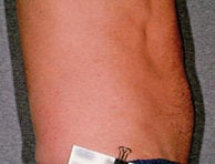 Liposonix 582688