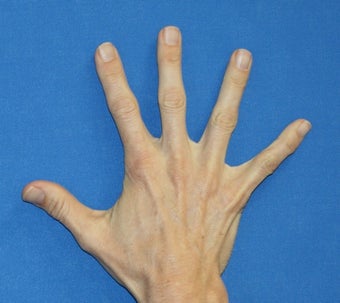 Filler in Hands before 385694