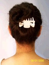 Ear Surgery (Otoplasty) 357655