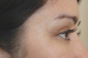 Latisse for eyelashes after 151333