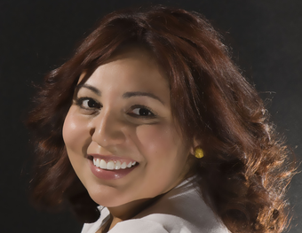 porcelain veneers after 363960