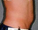 Liposonix 582729