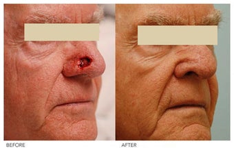 Facial Reconstruction before 136842