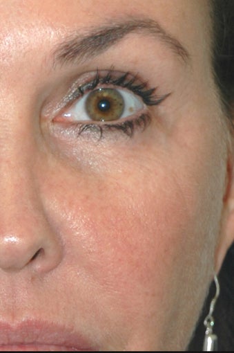 Skin Care after 620188