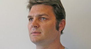 Facial Implant after 494443
