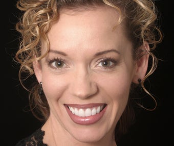 Porcelain Veneers after 374268