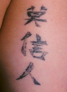 Laser tattoo removal before 374506