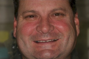 Full mouth dental reconstruction 90862