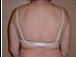 Body Jet after 379520
