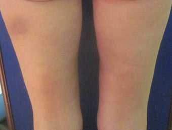 Cellulaze