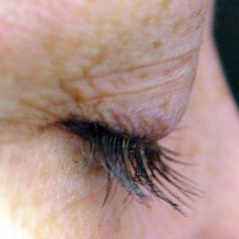 Dr. Lorrie Klein's eyelashes before and after Latisse after 152210