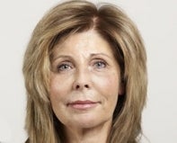 Non Surgical Facelift after 448776