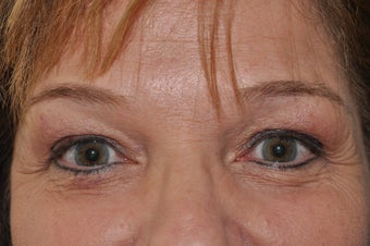 Permanent Eyeliner after 493479